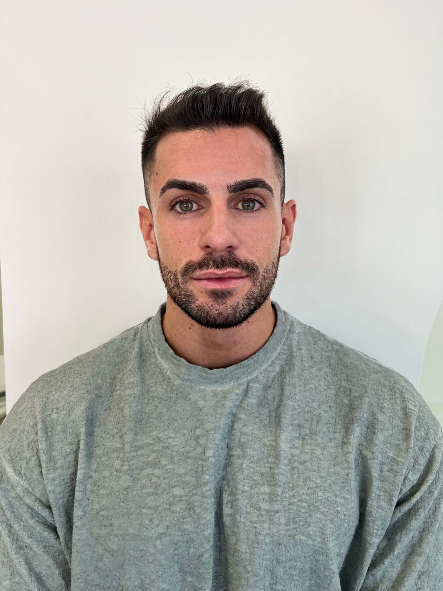 Masculinización Facial