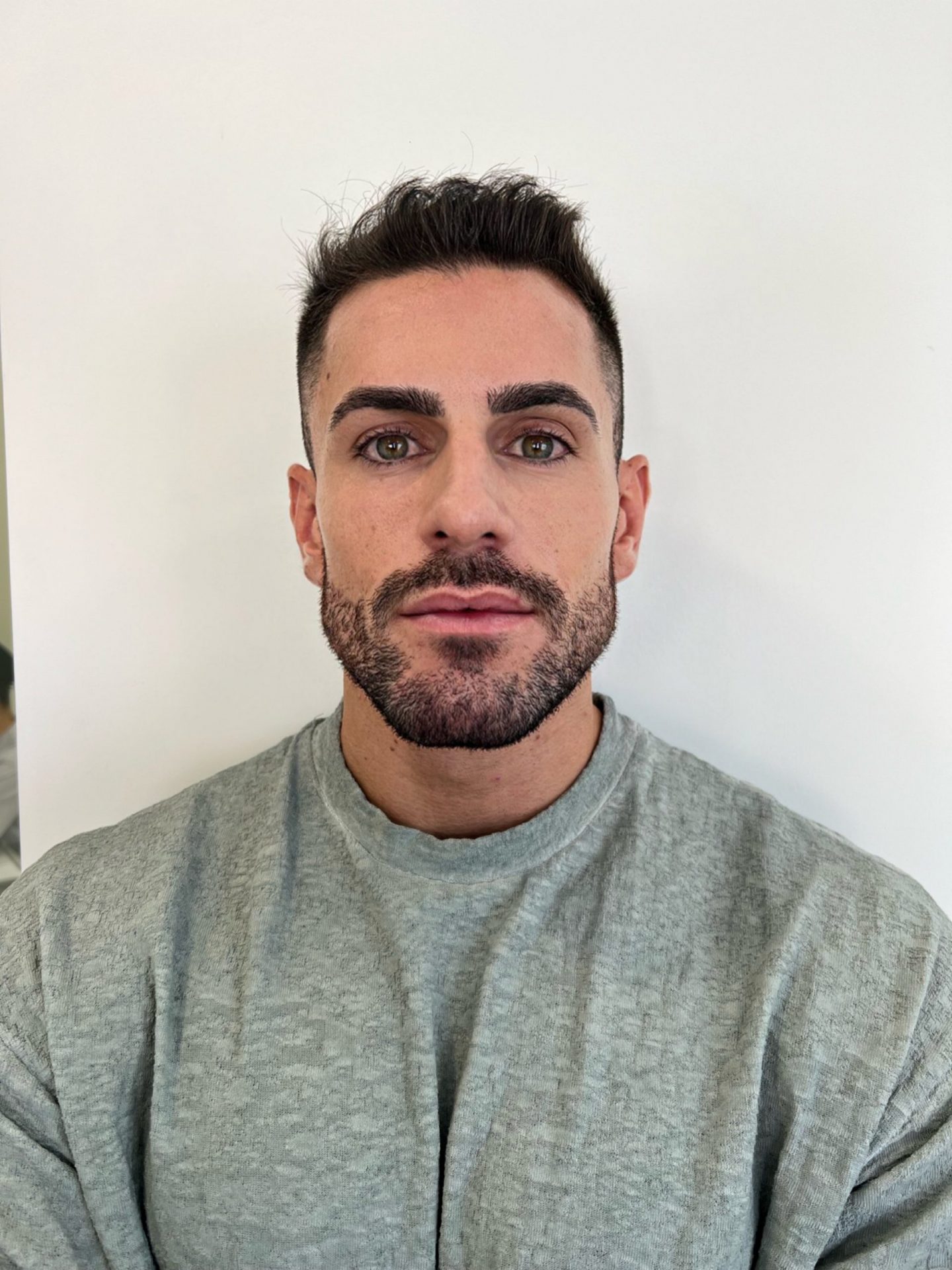 Masculinización Facial