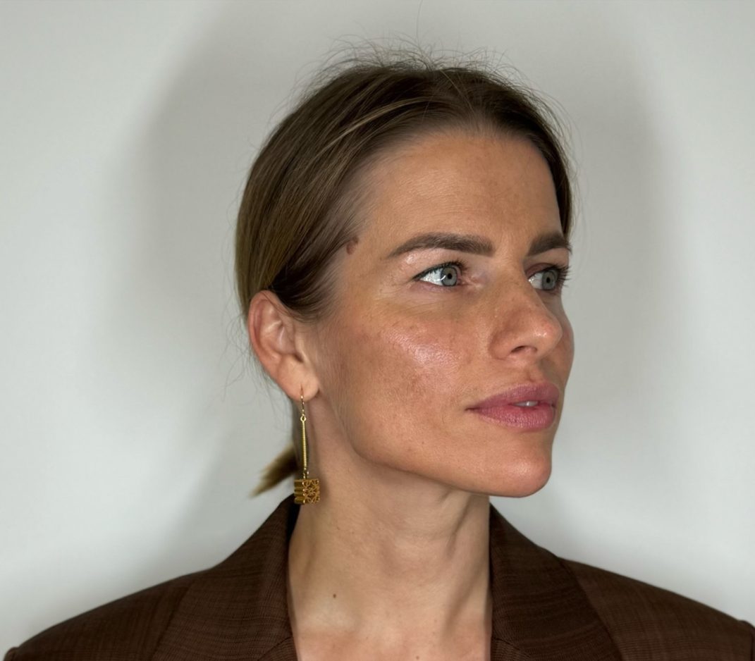 Armonización facial Femenina