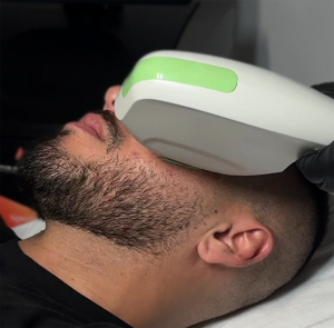 Tratamiento con Láser para manchas