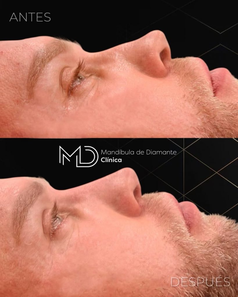 rinomodelacion barcelona