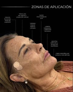 armonización facial