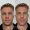 armonización facial