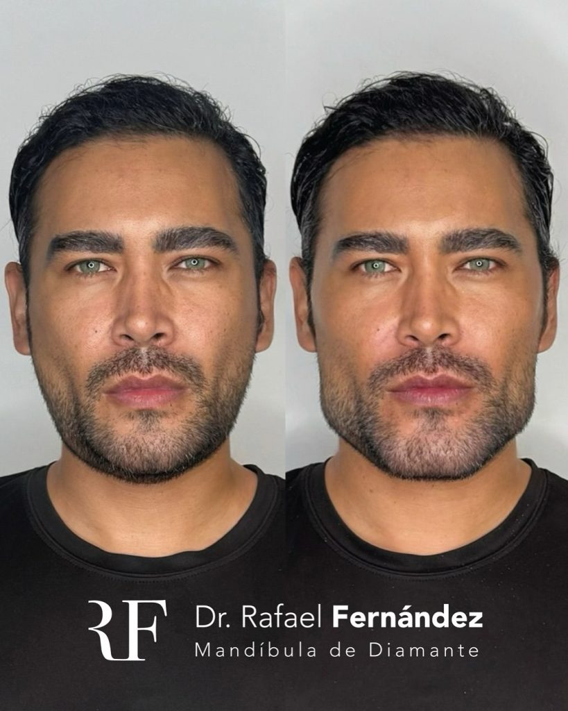 estética facial