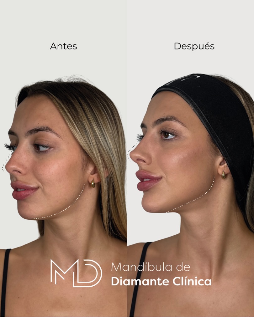 estética facial