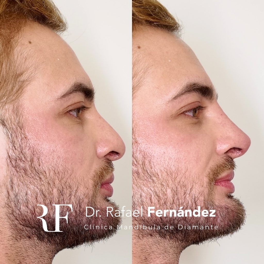 estética facial