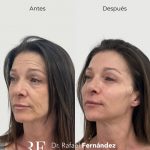 Medicina estética regenerativa