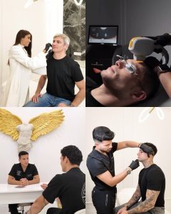 Facial Mesotherapy in Barcelona
