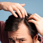 Finasteride Barcelona