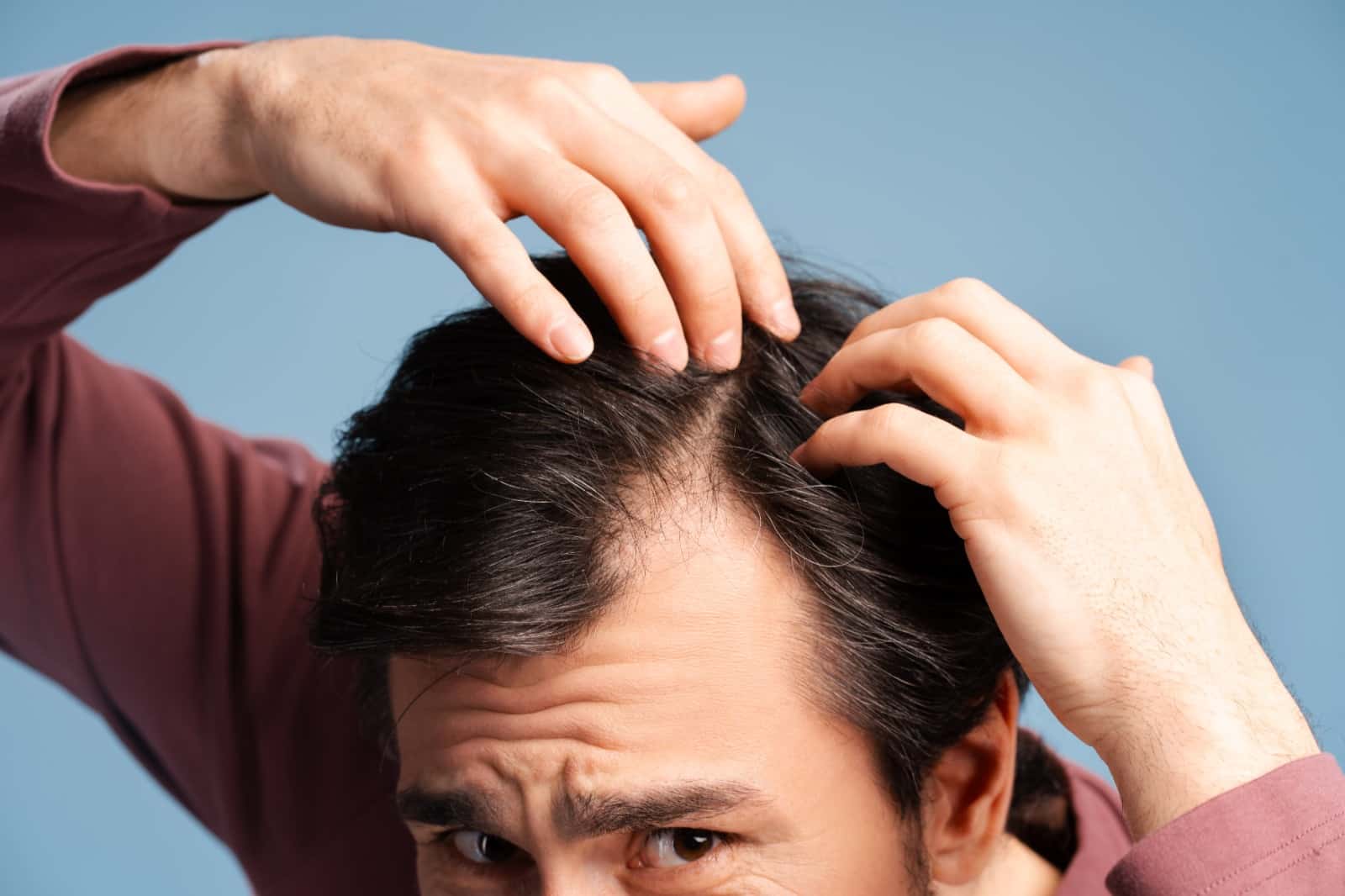 Finasteride Barcelona