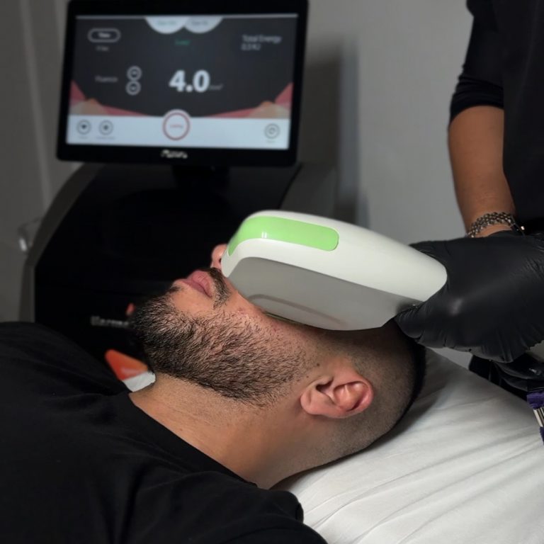 Tratamiento con Láser