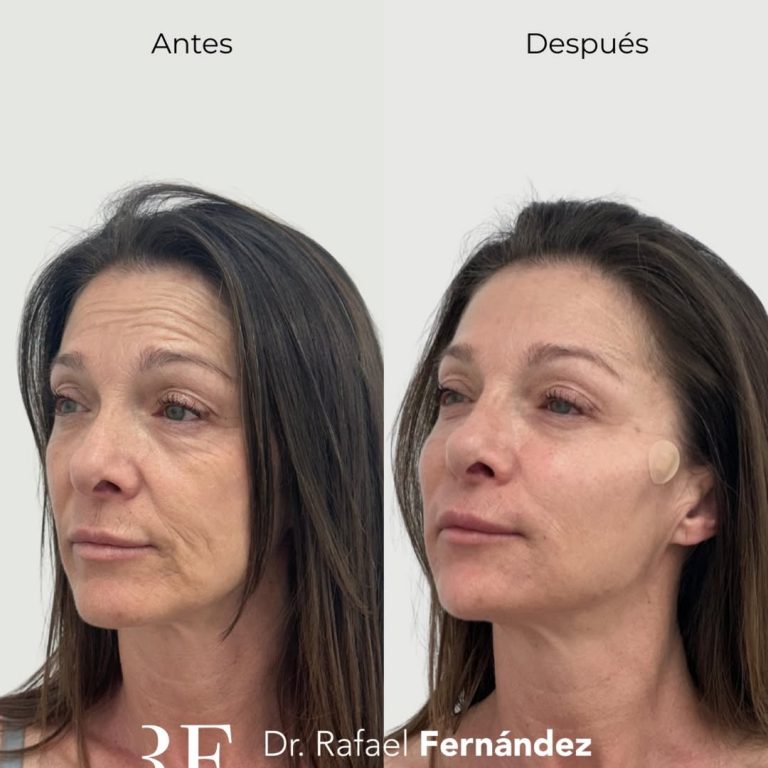 Medicina estética regenerativa