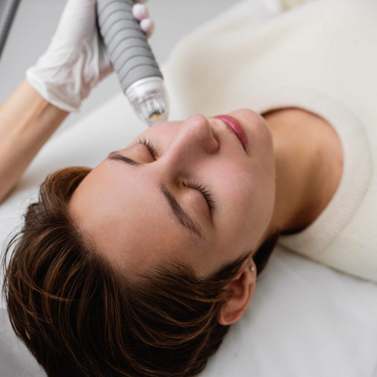 dermapen facial microneedling