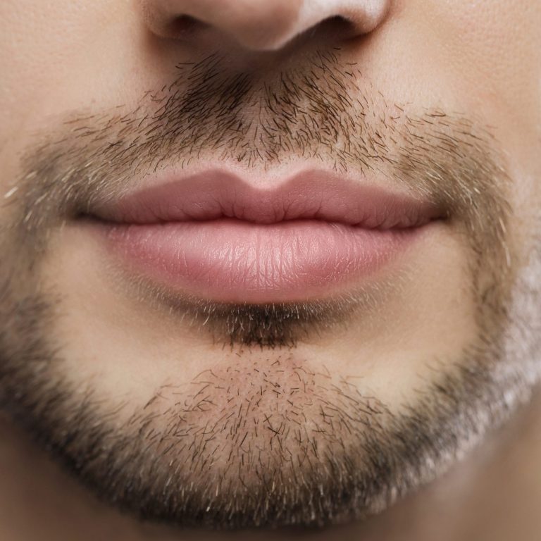 perfect-male-plump-lips-after-filler-injection-2024-10-18-05-10-28-utc